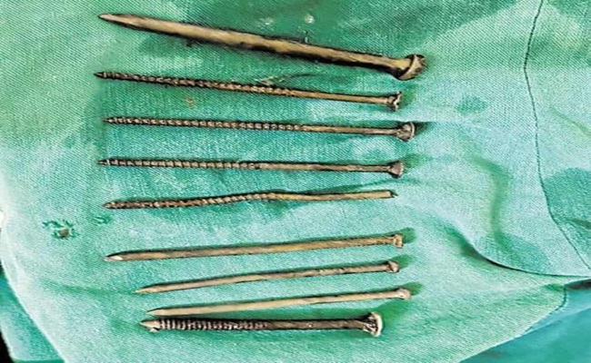 Shocking: 32 Nails In Prisoner's Stomach