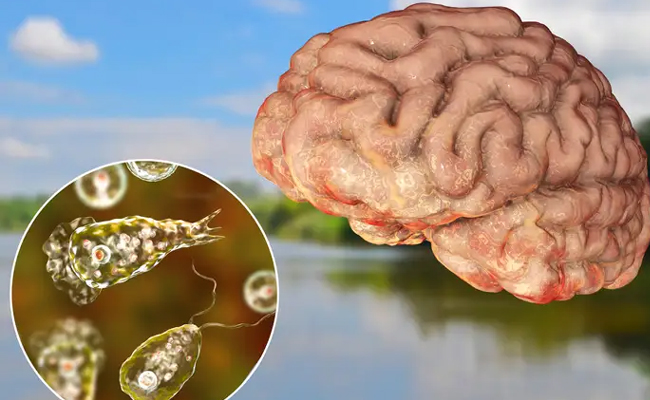 Brain Eating Insect.. 67 cases, 18 Deaths